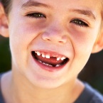 average age for tooth loss in children