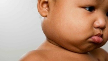 Kawasaki Disease in Infants & Young Children - HealthyChildren.org