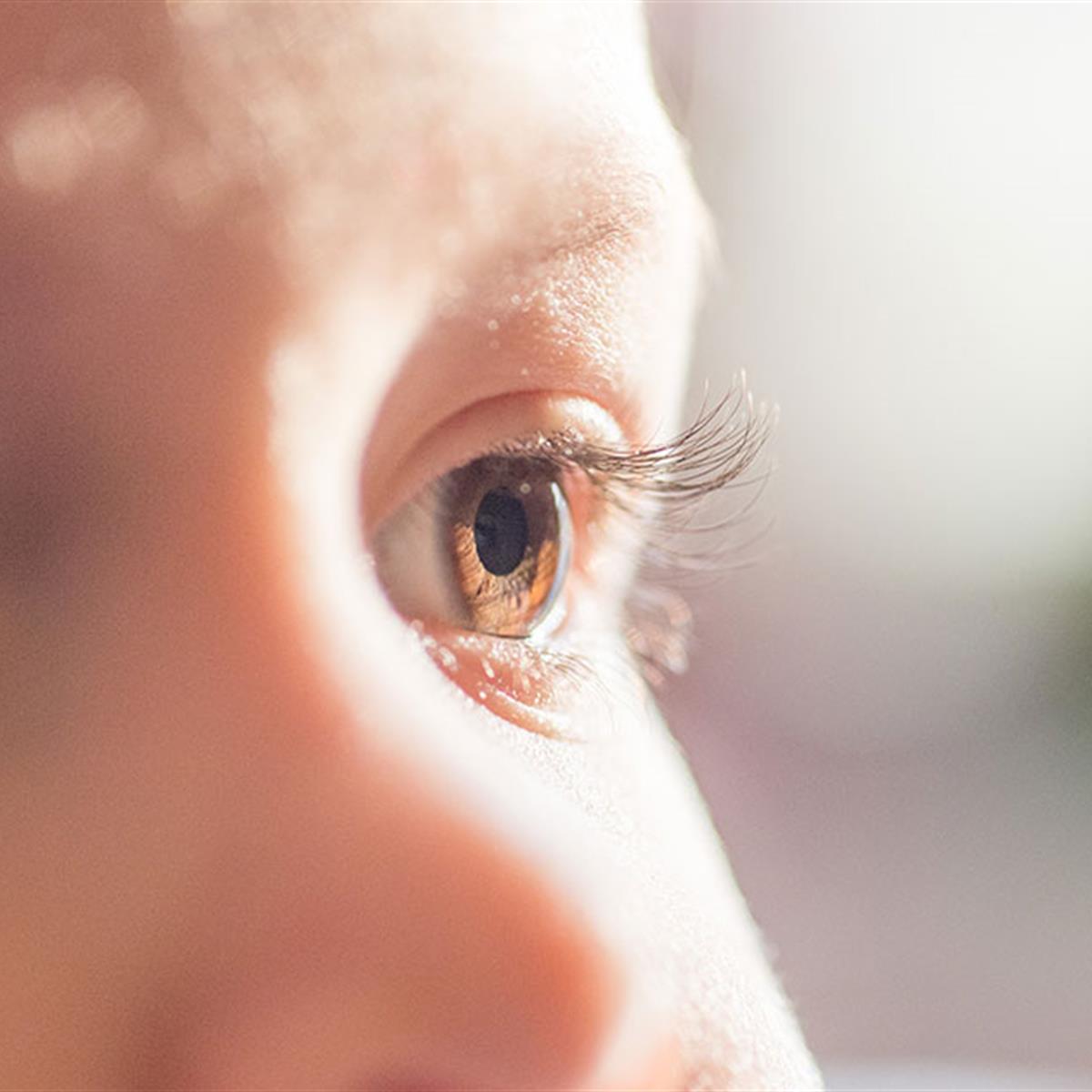 Cataracts in Children