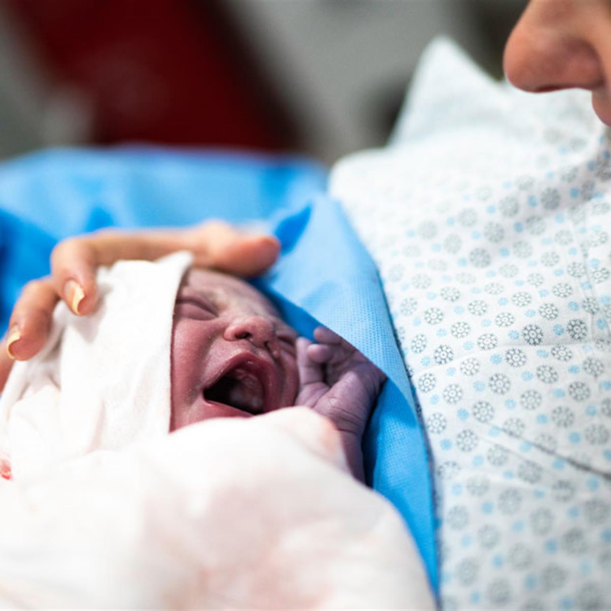 Breastfeeding After Cesarean (CSection) Delivery