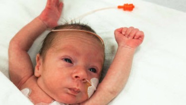 8 month premature baby