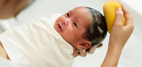 Qué es la costra láctea en el cuero cabelludo del recién nacido