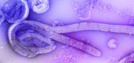 Ebola virus