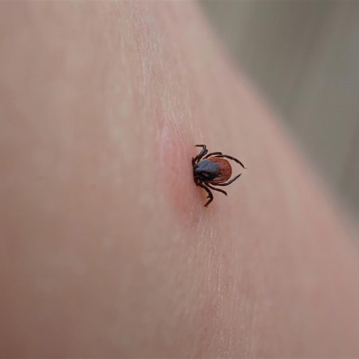 do dog ticks bite humans