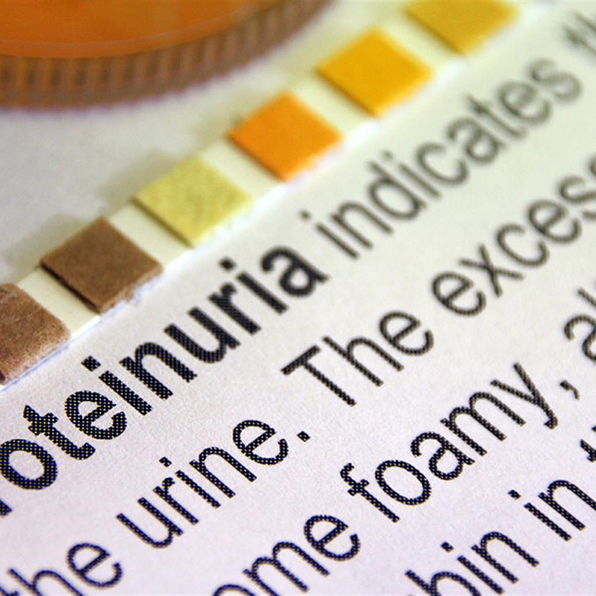 Proteinuria in Children