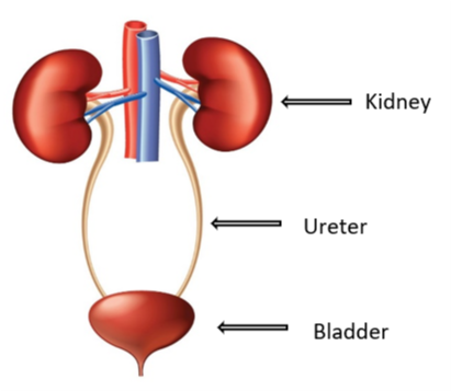 can exposure to agent orange cause bladder cancer