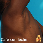 Manchas café con leche